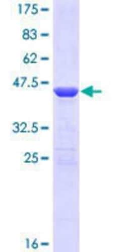 Novus Biologicals Recombinant Human ZFHX4 GST (N-Term) Protein 10 &mu;g | Buy Online | Novus Biologicals&trade; | Fisher Scientific
