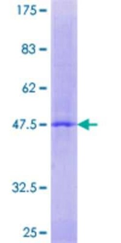 Novus Biologicals Recombinant Human RERGL GST (N-Term) Protein 2 &mu;g | Buy Online | Novus Biologicals&trade; | Fisher Scientific