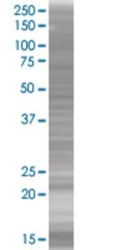Novus Biologicals RERGL 293T Cell Transient Overexpression Lysate 0.1 mL | Buy Online | Novus Biologicals&trade; | Fisher Scientific