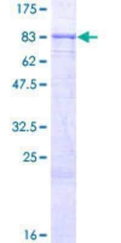 Novus Biologicals Recombinant Human KLHL36 GST (N-Term) Protein 25 &mu;g | Buy Online | Novus Biologicals&trade; | Fisher Scientific