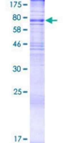 Novus Biologicals Recombinant Human ALG9 GST (N-Term) Protein 2 &mu;g | Buy Online | Novus Biologicals&trade; | Fisher Scientific