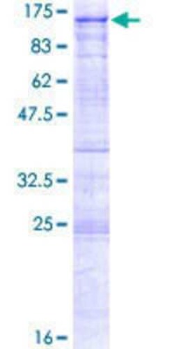 Novus Biologicals Recombinant Human ALS2CR8 GST (N-Term) Protein 25 &mu;g | Buy Online | Novus Biologicals&trade; | Fisher Scientific