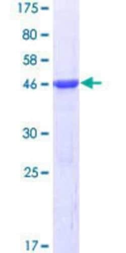 Novus Biologicals Recombinant Human ALS2CR8 GST (N-Term) Protein 10 &mu;g | Buy Online | Novus Biologicals&trade; | Fisher Scientific