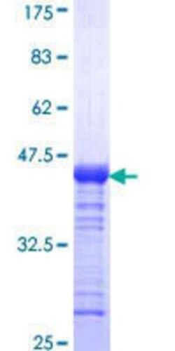 Novus Biologicals Recombinant Human GLP/EHMT1 GST (N-Term) Protein 10 &mu;g | Buy Online | Novus Biologicals&trade; | Fisher Scientific