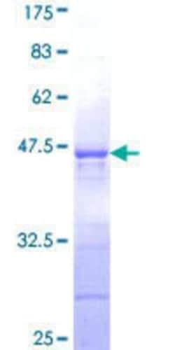 Novus Biologicals Recombinant Human LONRF3 GST (N-Term) Protein 25 &mu;g | Buy Online | Novus Biologicals&trade; | Fisher Scientific