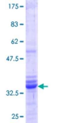 Novus Biologicals Recombinant Human PIP5K2 gamma GST (N-Term) Protein 10 &mu;g | Buy Online | Novus Biologicals&trade; | Fisher Scientific