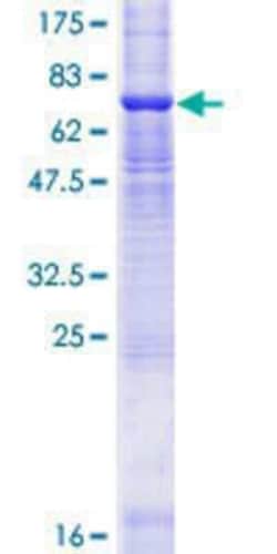 Novus Biologicals Recombinant Human ZDHHC11 GST (N-Term) Protein 25 &mu;g | Buy Online | Novus Biologicals&trade; | Fisher Scientific