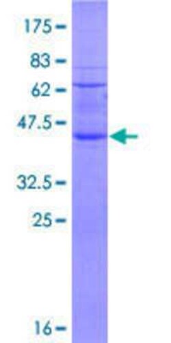Novus Biologicals Recombinant Human RNF122 GST (N-Term) Protein 25 &mu;g | Buy Online | Novus Biologicals&trade; | Fisher Scientific