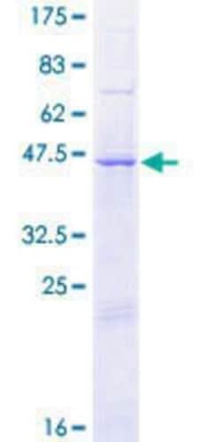 Novus Biologicals Recombinant Human DCAKD GST (N-Term) Protein 25 &mu;g | Buy Online | Novus Biologicals&trade; | Fisher Scientific