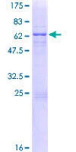 Novus Biologicals Recombinant Human ZC3H14 GST (N-Term) Protein 25 &mu;g | Buy Online | Novus Biologicals&trade; | Fisher Scientific