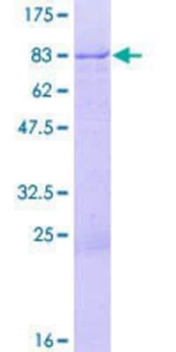 Novus Biologicals Recombinant Human ZNF671 GST (N-Term) Protein 25 &mu;g | Buy Online | Novus Biologicals&trade; | Fisher Scientific