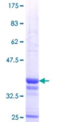 Novus Biologicals&trade;&nbsp;Recombinant Human ATP8B4 GST (N-Term) Protein