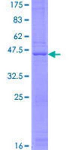 Novus Biologicals Recombinant Human RPP21 GST (N-Term) Protein 25 &mu;g | Buy Online | Novus Biologicals&trade; | Fisher Scientific