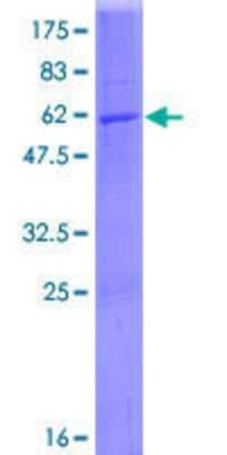 Novus Biologicals Recombinant Human Dehydrodolichyl Diphosphate Synthase GST (N-Term) Protein 25 &mu;g | Buy Online | Novus Biologicals&trade; | Fisher Scientific