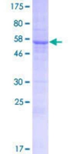 Novus Biologicals Recombinant Human ERMP1 GST (N-Term) Protein 10 &mu;g | Buy Online | Novus Biologicals&trade; | Fisher Scientific