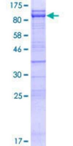 Novus Biologicals Recombinant Human CEP76 GST (N-Term) Protein 10 &mu;g | Buy Online | Novus Biologicals&trade; | Fisher Scientific