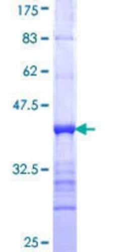 Novus Biologicals Recombinant Human GRHL2 GST (N-Term) Protein 25 &mu;g | Buy Online | Novus Biologicals&trade; | Fisher Scientific