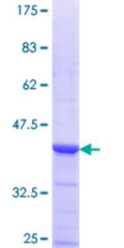 Novus Biologicals Recombinant Human DSN1 GST (N-Term) Protein 25 &mu;g | Buy Online | Novus Biologicals&trade; | Fisher Scientific