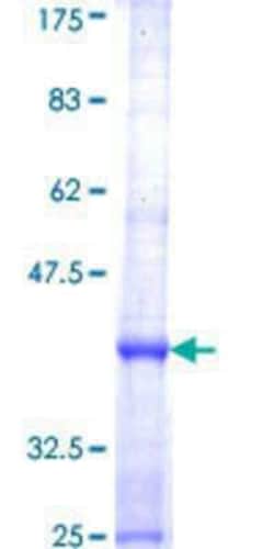 Novus Biologicals Recombinant Human Dock5 GST (N-Term) Protein 10 &mu;g | Buy Online | Novus Biologicals&trade; | Fisher Scientific