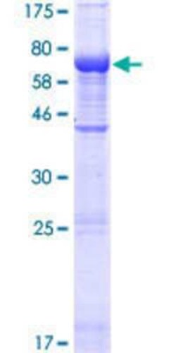 Novus Biologicals Recombinant Human C10orf88 GST (N-Term) Protein 25 &mu;g | Buy Online | Novus Biologicals&trade; | Fisher Scientific