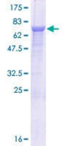 Novus Biologicals Recombinant Human MINDY3 GST (N-Term) Protein 10 &mu;g | Buy Online | Novus Biologicals&trade; | Fisher Scientific