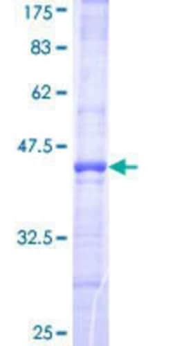 Novus Biologicals Recombinant Human FBXL18 GST (N-Term) Protein 25 &mu;g | Buy Online | Novus Biologicals&trade; | Fisher Scientific