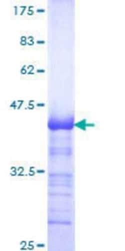 Novus Biologicals Recombinant Human CSRNP3 GST (N-Term) Protein 10 &mu;g | Buy Online | Novus Biologicals&trade; | Fisher Scientific