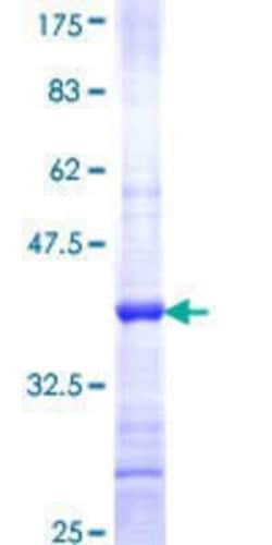 Novus Biologicals Recombinant Human PGAP1 GST (N-Term) Protein 25 &mu;g | Buy Online | Novus Biologicals&trade; | Fisher Scientific