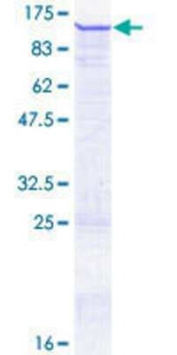 Novus Biologicals Recombinant Human ZNF606 GST (N-Term) Protein 25 &mu;g | Buy Online | Novus Biologicals&trade; | Fisher Scientific