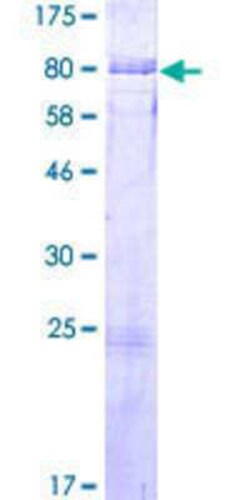 Novus Biologicals Recombinant Human BAIAP2L2 GST (N-Term) Protein 2 &mu;g | Buy Online | Novus Biologicals&trade; | Fisher Scientific
