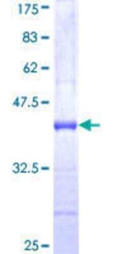 Novus Biologicals Recombinant Human TRIM46 GST (N-Term) Protein 10 &mu;g | Buy Online | Novus Biologicals&trade; | Fisher Scientific