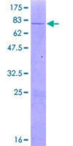 Novus Biologicals Recombinant Human UXS1 GST (N-Term) Protein 2 &mu;g | Buy Online | Novus Biologicals&trade; | Fisher Scientific