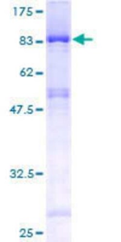 Novus Biologicals Recombinant Human EDC3 GST (N-Term) Protein 25 &mu;g | Buy Online | Novus Biologicals&trade; | Fisher Scientific