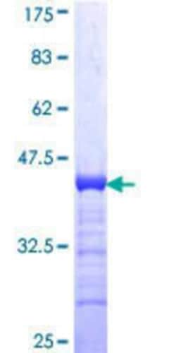 Novus Biologicals Recombinant Human IFT74 GST (N-Term) Protein 25 &mu;g | Buy Online | Novus Biologicals&trade; | Fisher Scientific