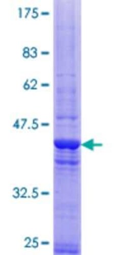 Novus Biologicals Recombinant Human CEP290 GST (N-Term) Protein 10 &mu;g | Buy Online | Novus Biologicals&trade; | Fisher Scientific