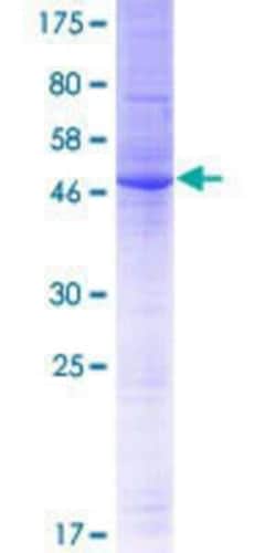 Novus Biologicals Recombinant Human TMEM134 GST (N-Term) Protein 10 &mu;g | Buy Online | Novus Biologicals&trade; | Fisher Scientific