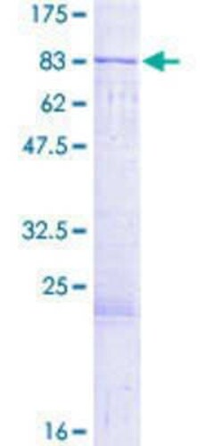 Novus Biologicals Recombinant Human Mus81 GST (N-Term) Protein 2 &mu;g | Buy Online | Novus Biologicals&trade; | Fisher Scientific