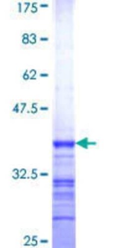 Novus Biologicals Recombinant Human Mus81 GST (N-Term) Protein 2 &mu;g | Buy Online | Novus Biologicals&trade; | Fisher Scientific