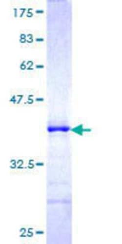 Novus Biologicals Recombinant Human FBXO11 GST (N-Term) Protein 10 &mu;g | Buy Online | Novus Biologicals&trade; | Fisher Scientific