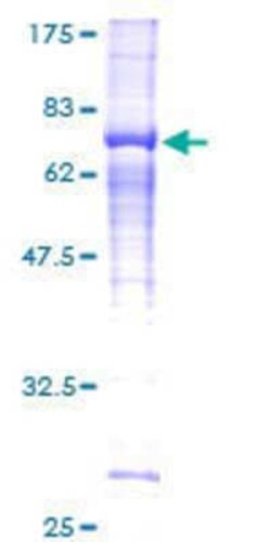 Novus Biologicals Recombinant Human SPG11 GST (N-Term) Protein 25 &mu;g | Buy Online | Novus Biologicals&trade; | Fisher Scientific