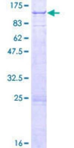Novus Biologicals Recombinant Human TARS2 GST (N-Term) Protein 2 &mu;g | Buy Online | Novus Biologicals&trade; | Fisher Scientific