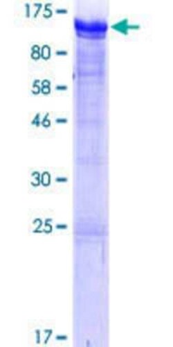 Novus Biologicals Recombinant Human FIP1/RCP GST (N-Term) Protein 25 &mu;g | Buy Online | Novus Biologicals&trade; | Fisher Scientific