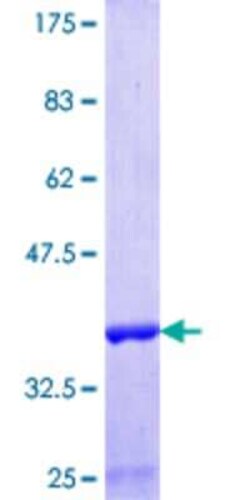 Novus Biologicals Recombinant Human FIP1/RCP GST (N-Term) Protein 25 &mu;g | Buy Online | Novus Biologicals&trade; | Fisher Scientific
