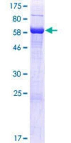 Novus Biologicals Recombinant Human LIN10 GST (N-Term) Protein 10 &mu;g | Buy Online | Novus Biologicals&trade; | Fisher Scientific