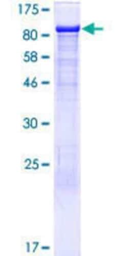 Novus Biologicals Recombinant Human IP3KC GST (N-Term) Protein 10 &mu;g | Buy Online | Novus Biologicals&trade; | Fisher Scientific