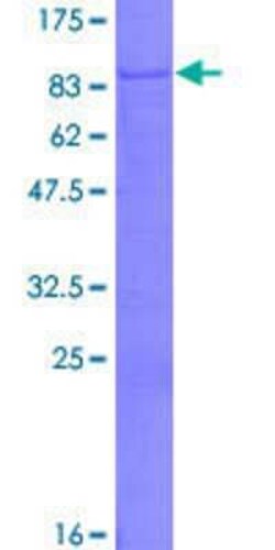 Novus Biologicals Recombinant Human PLEKHO2 GST (N-Term) Protein 2 &mu;g | Buy Online | Novus Biologicals&trade; | Fisher Scientific