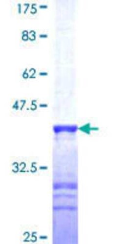 Novus Biologicals Recombinant Human PLEKHO2 GST (N-Term) Protein 25 &mu;g | Buy Online | Novus Biologicals&trade; | Fisher Scientific