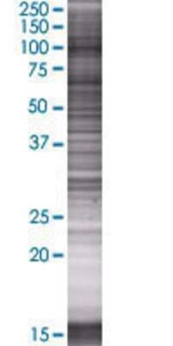 Novus Biologicals&trade;&nbsp;EPC1 293T Cell Transient Overexpression Lysate