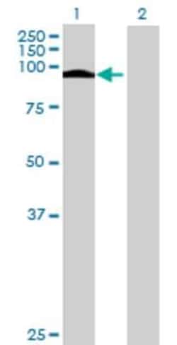 Novus Biologicals EPC1 293T Cell Transient Overexpression Lysate 0.1 mL | Buy Online | Novus Biologicals&trade; | Fisher Scientific