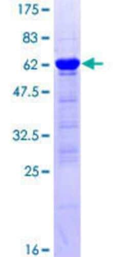 Novus Biologicals Recombinant Human PPP1R2P9 GST (N-Term) Protein 10 &mu;g | Buy Online | Novus Biologicals&trade; | Fisher Scientific